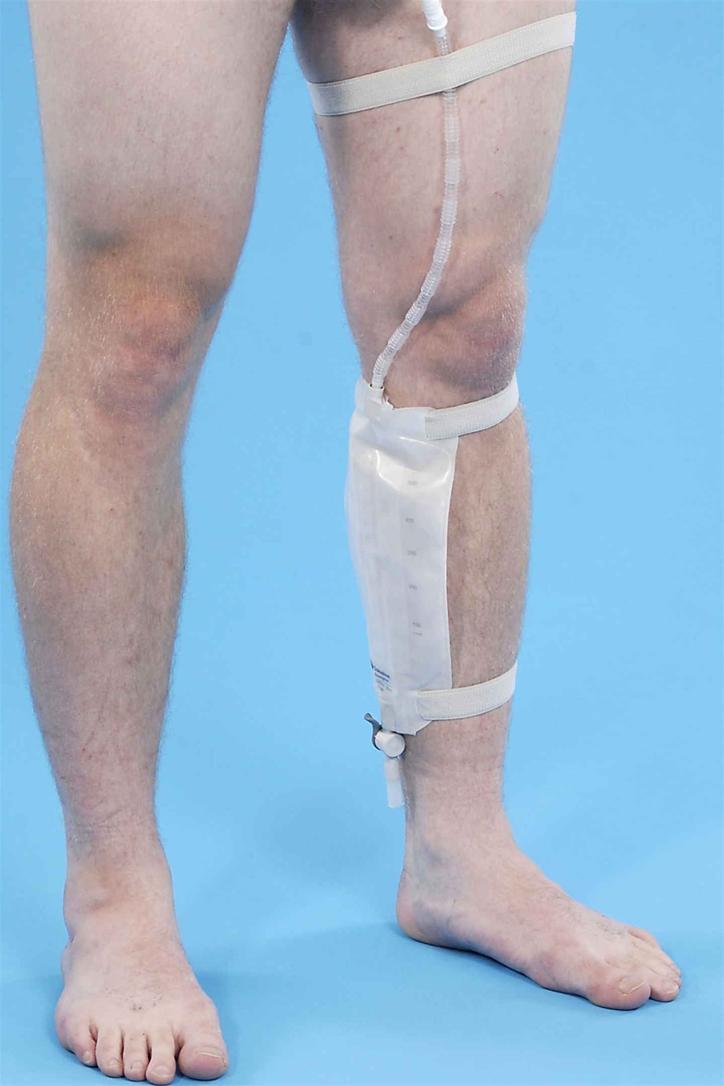 What Is A Catheter 