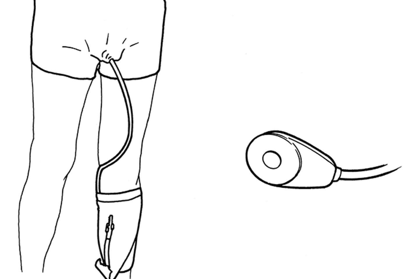 Body worn urinal with soft cup - line drawing