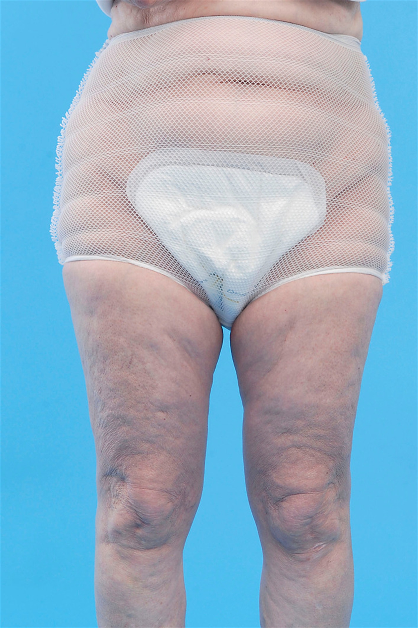 Large disposable pad with net support pants