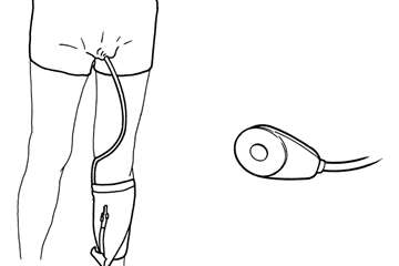 Body worn urinal with soft cup - line drawing